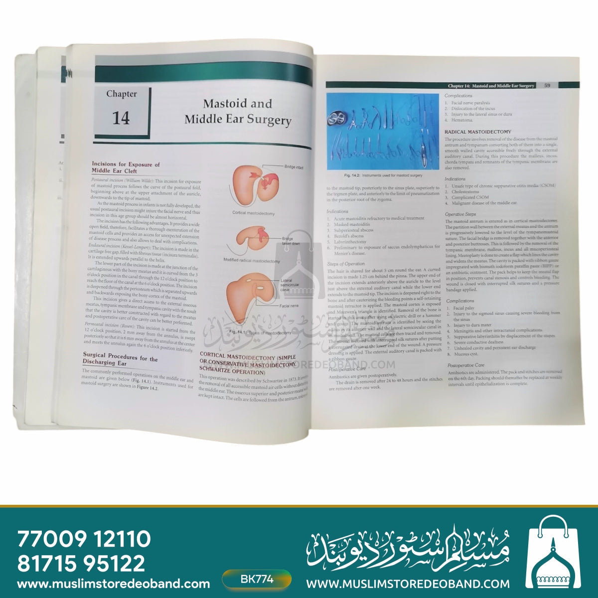 Textbook of Ear, Nose & Throat Diseases